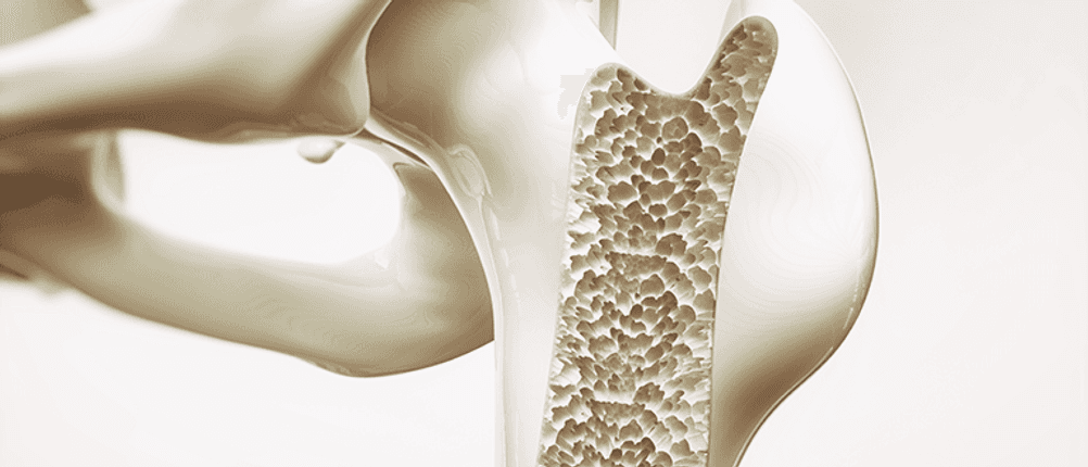 vitamin d tabletten wirken sich auf den calcium spiegel und den knochenaufbau aus