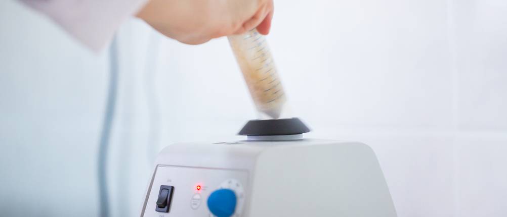 Vortex-Mixer im Test: Hand platziert Probe auf Vortex-Mixer