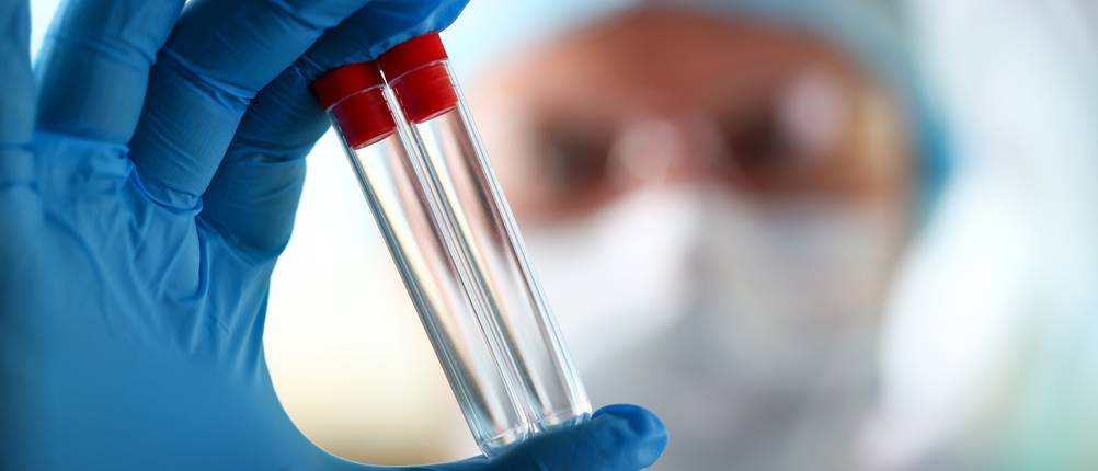 Wassertest-Test: Eine Person in Schutzkleidung hält zwei Wasserproben in kleinen Reagenzgläsern in der Hand.