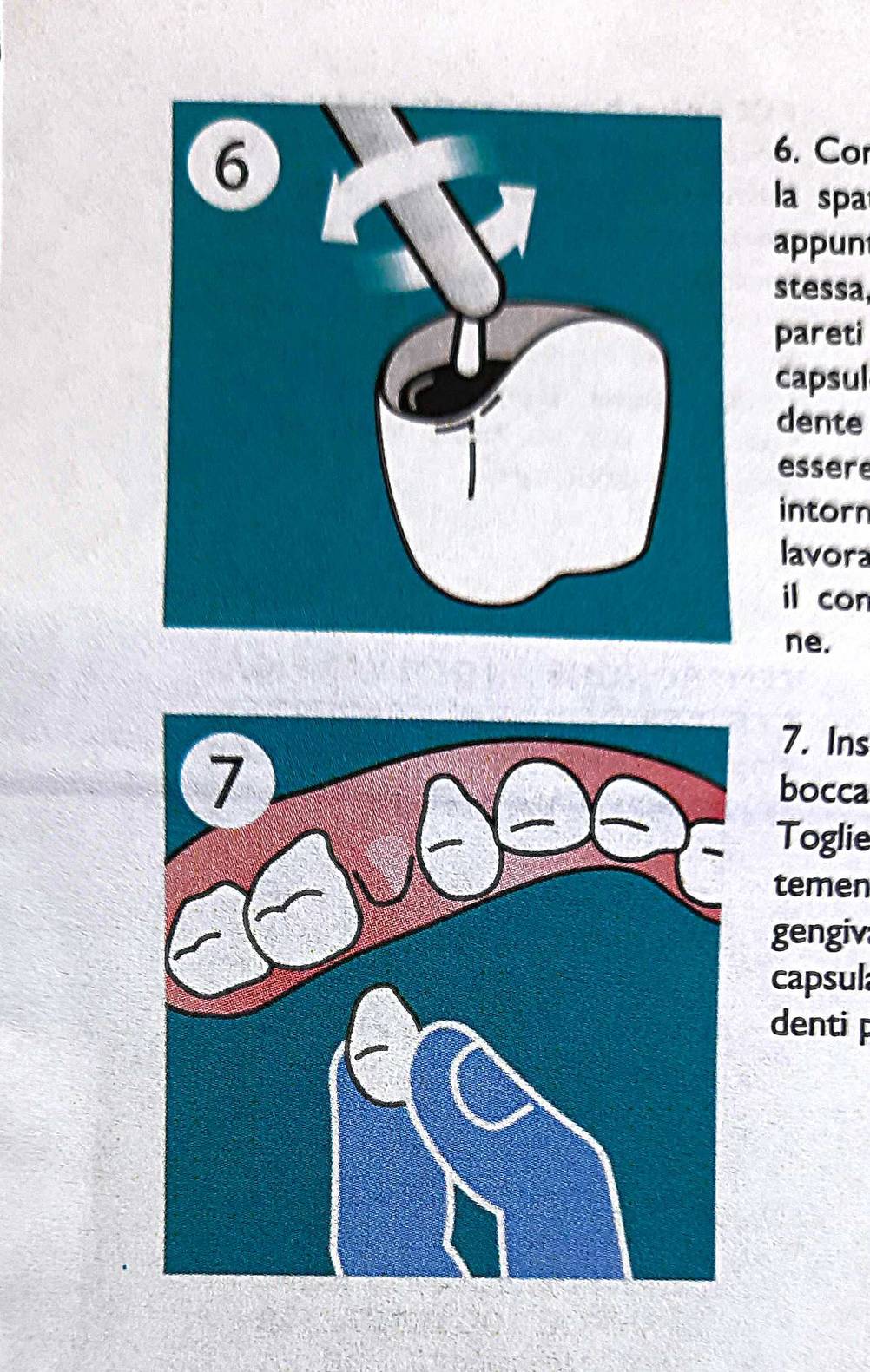 Zahnzement-Test: Nahaufnahme der Infografiken.